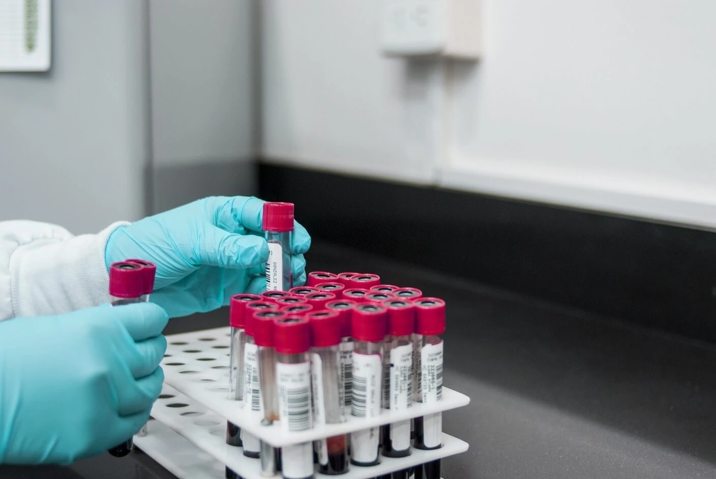 Can I Order a Blood Test Without Seeing a Doctor?