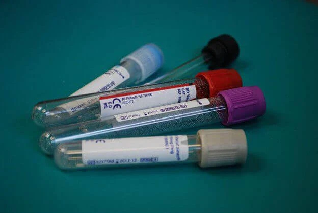 How Does Ordering Blood Tests Online Work?